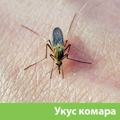 Укусы комаров в Копейске
