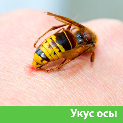 Профессиональное уничтожение ос и шершней в Копейске